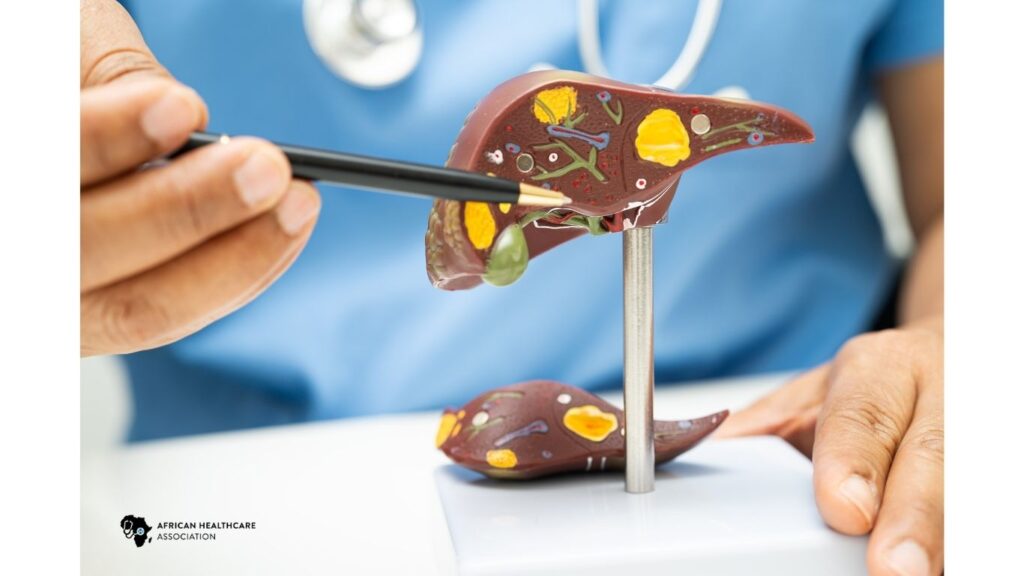 signs of liver disease 