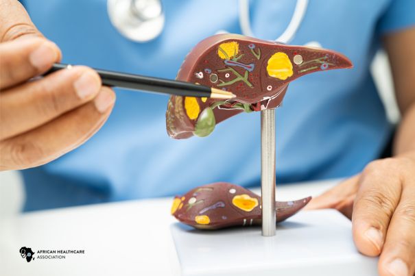 image of a human liver